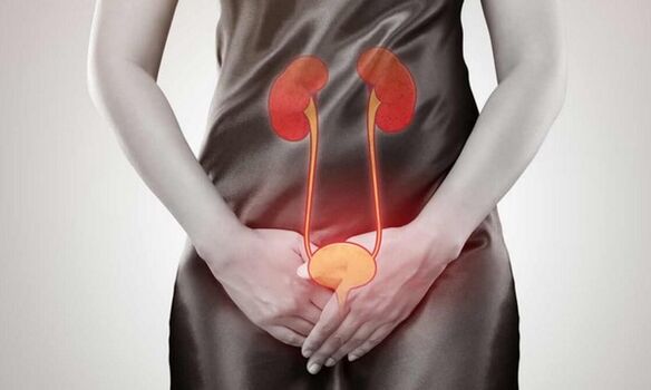 Causes et traitement de la cystite chez les femmes