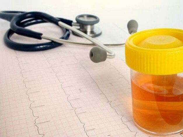 Analyse d'urine pour diagnostiquer la cystite